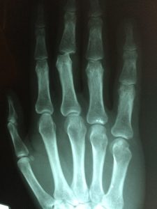 Home Illustratie van orthopedie in Waalwijk met focus op bewegingsapparaat behandelingen en revalidatie